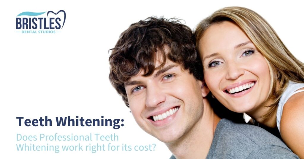 How Effective Professional Teeth Whitening Work Vs Cost