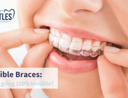 Invisible Braces Cost in Chandigarh: What are the options available?