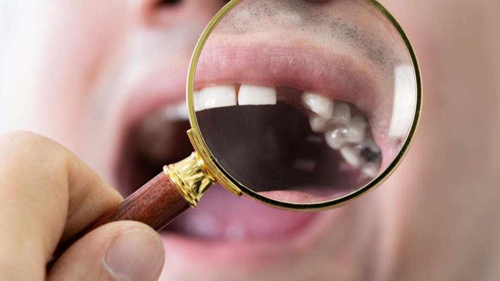 missing teeth with magnifying glass can be treated with dental implants in chandigarh