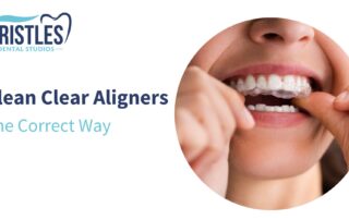 how to wear dental clear aligners at home - the right way shown in the image