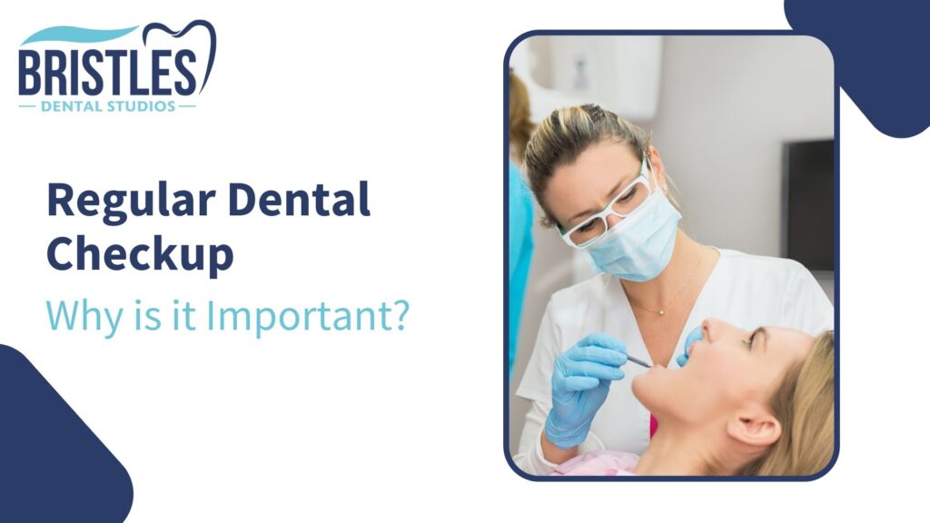 Dental Checkups: Importance of Regular Checkups
