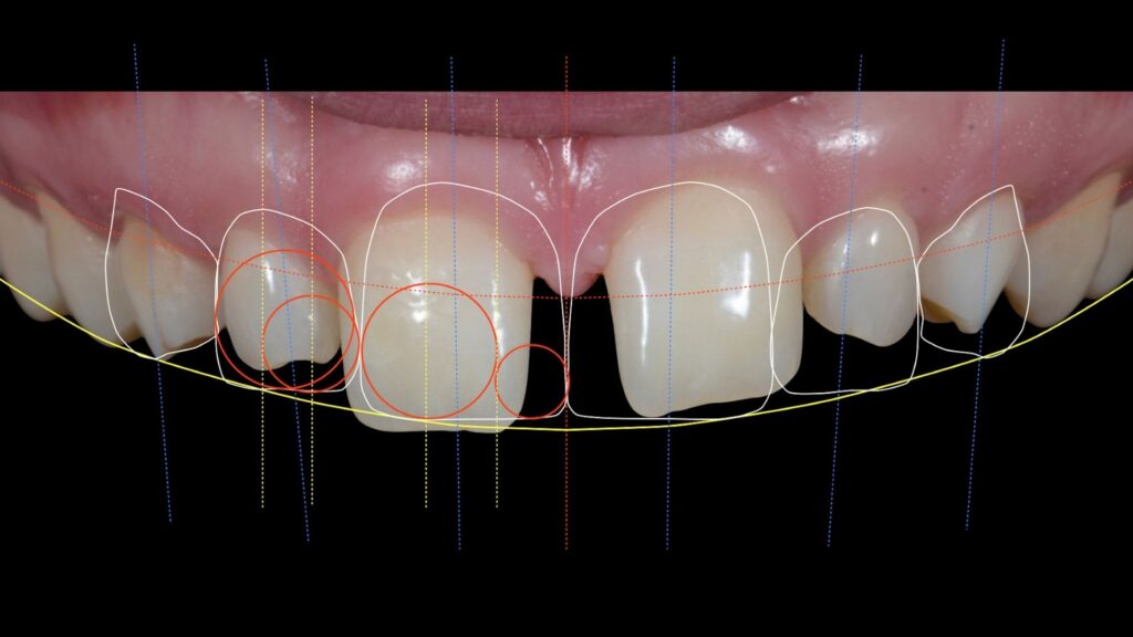 image showing 3d Smile Makeover in Chandigarh