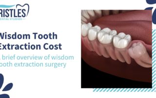 A brief overview of wisdom tooth extraction: wisdom tooth extraction cost Chandigarh