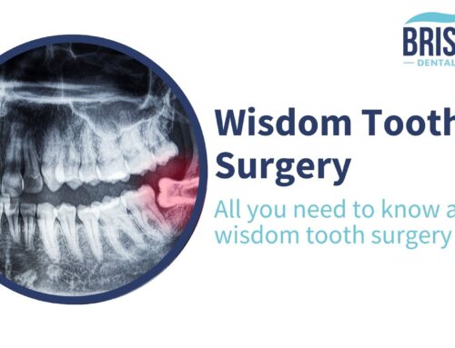 Wisdom Tooth Surgery: All you need to know about Wisdom Tooth Surgery