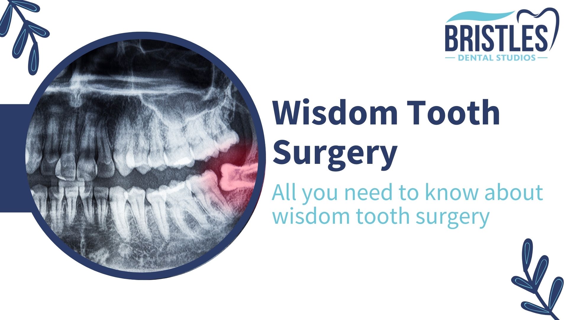 wisdom-tooth-surgery-chandigarh A person eating apple, toothache. Does a Root Canal Hurt? How Painful is a Root Canal? : Root Canal Pain