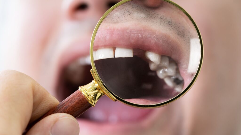 Missing Teeth Treatment Chandigarh